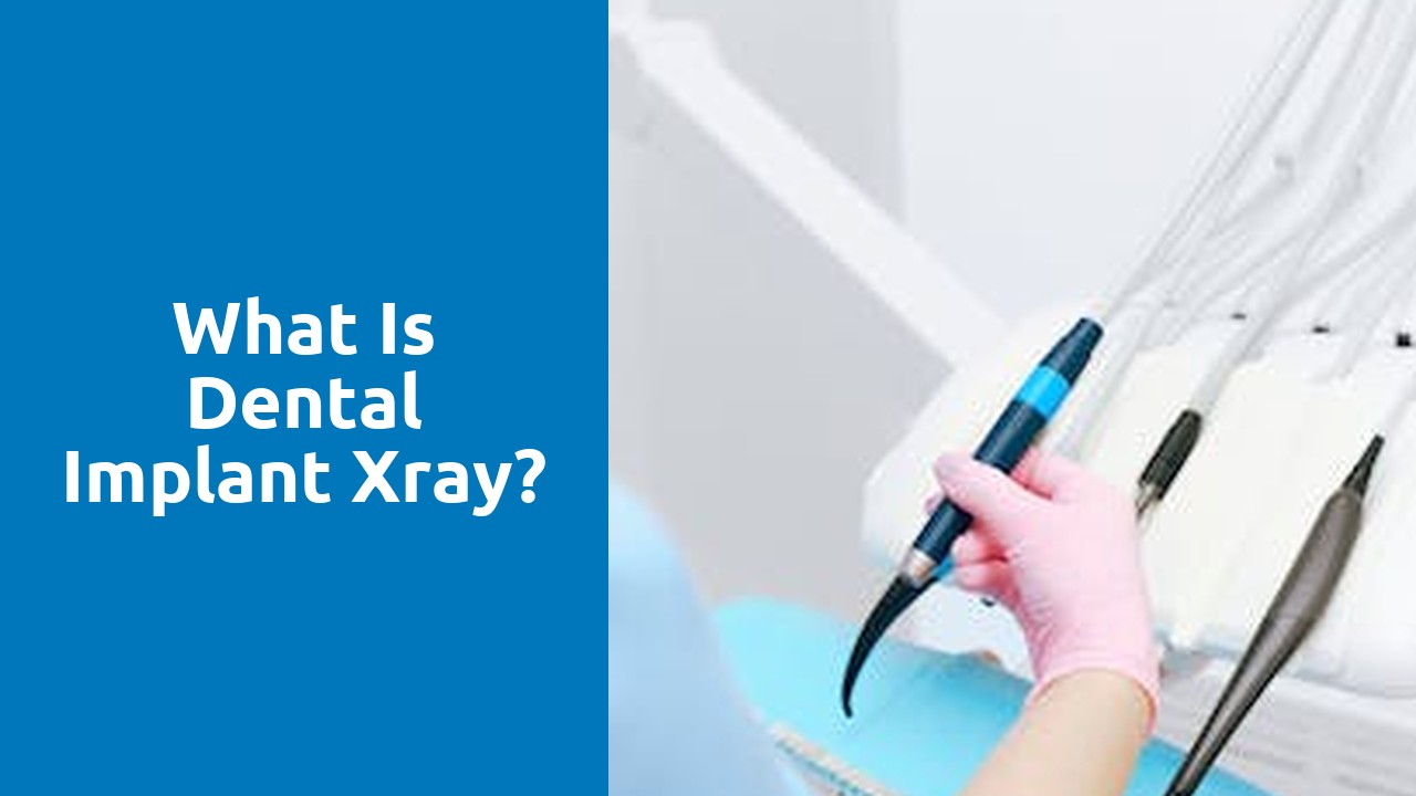 What is dental implant xray?