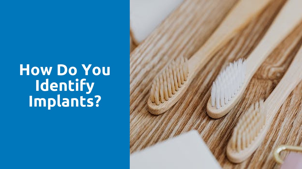 How do you identify implants?