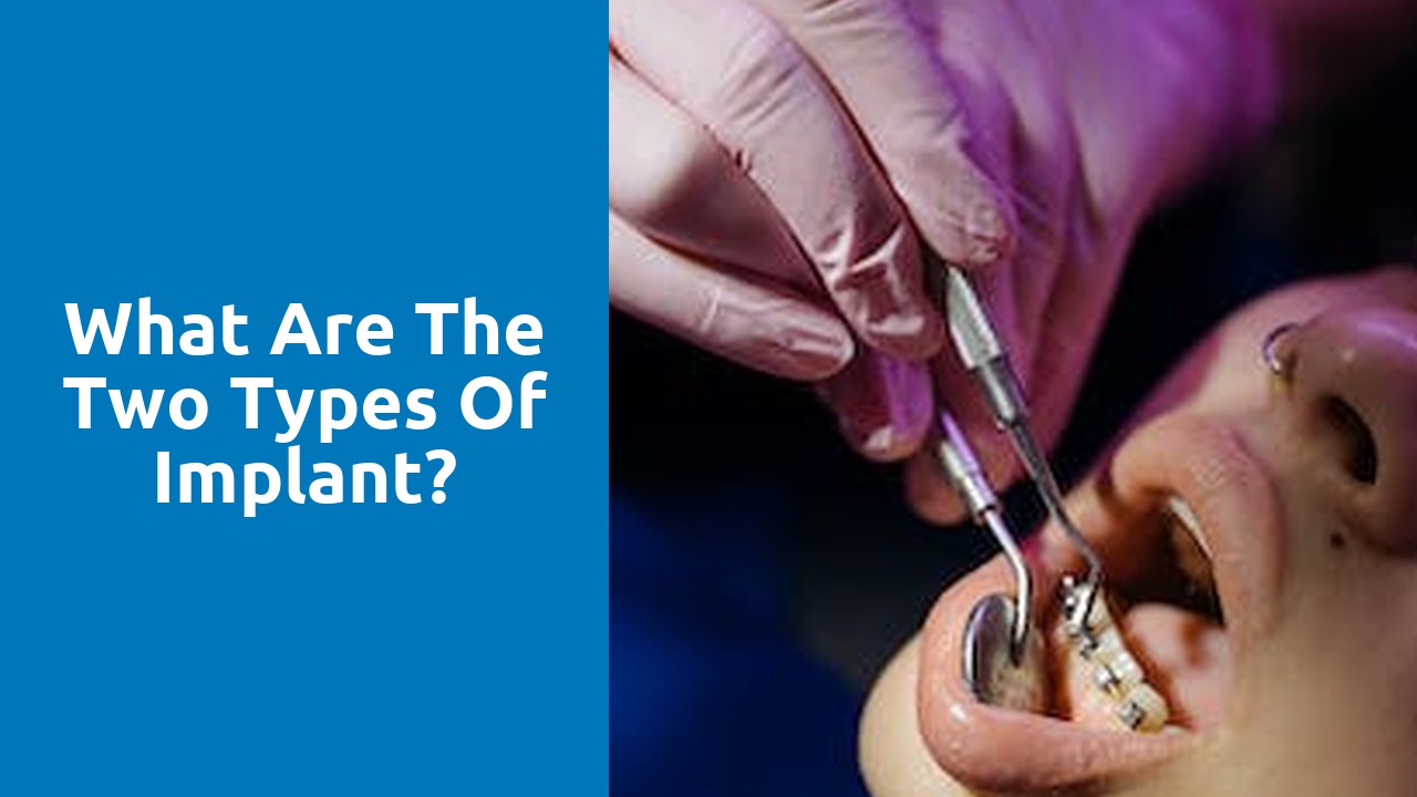 What are the two types of implant?