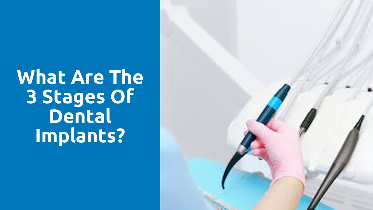What are the 3 stages of dental implants?